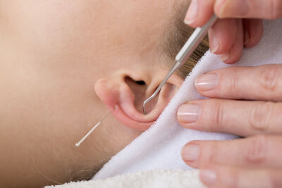 NADA-akupunktur – øreakupunktur for stress og avhengigheter