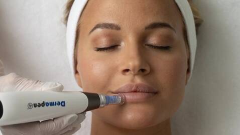 Dermapen med Exosomer