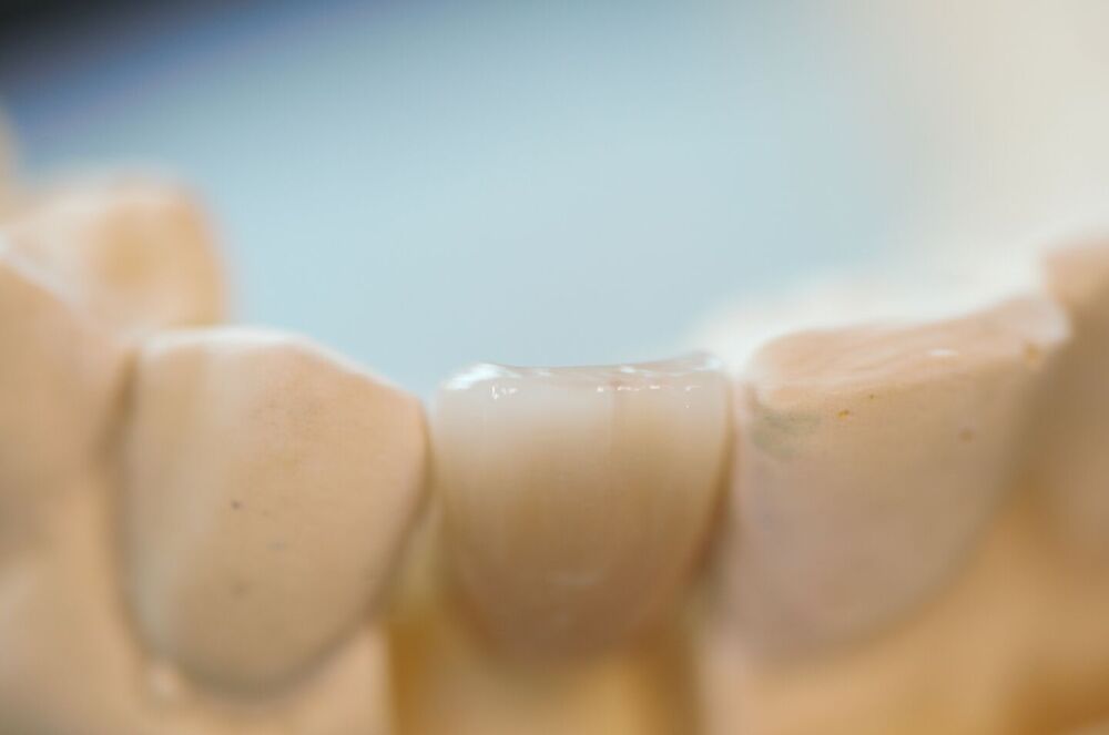 mortensendental 238740